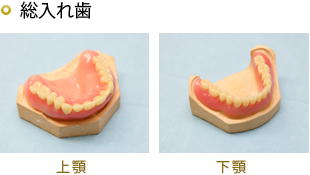 レジン床義歯 保険適応